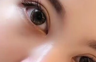 開眼角有沒有風險？