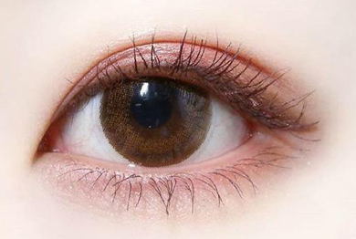 開眼角術(shù)后多久才能恢復(fù)？