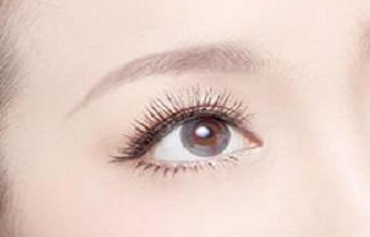 開眼角術(shù)的恢復(fù)期是多久？開眼角術(shù)的注意事項(xiàng)有哪些？