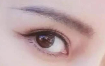 外眼角開大會留疤嗎？