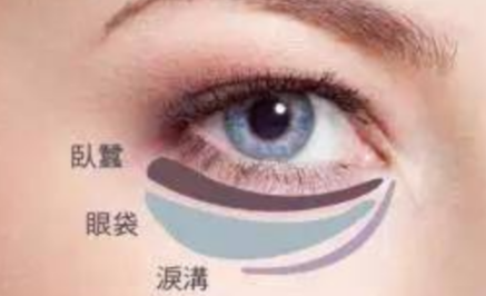 激光能祛除眼袋嗎？