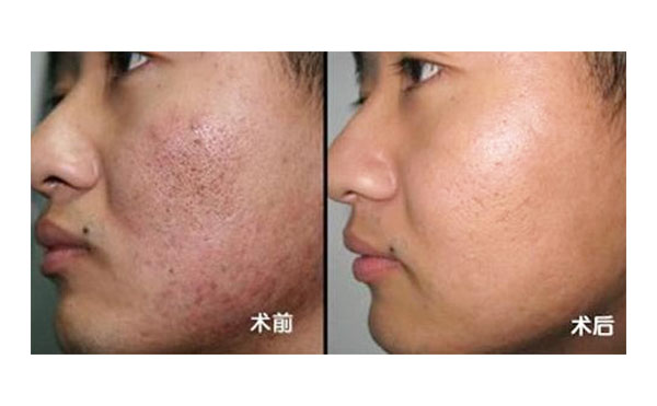 黑臉娃娃有風險嗎？