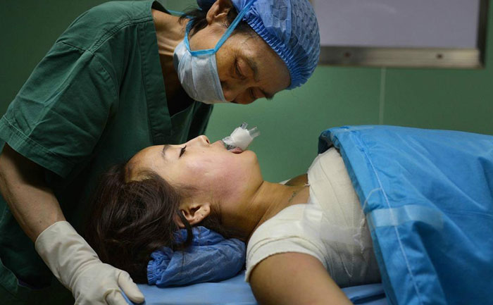 假體隆胸效果自然嗎？能維持多久？