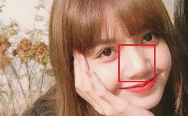 鼻子太大怎么辦？怎么改善大鼻頭