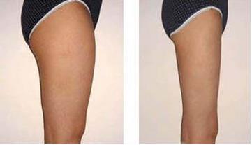 臀部下垂怎么提升？