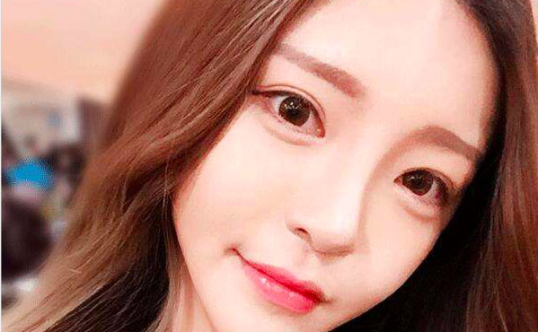 韓式開眼角的費用是多少？