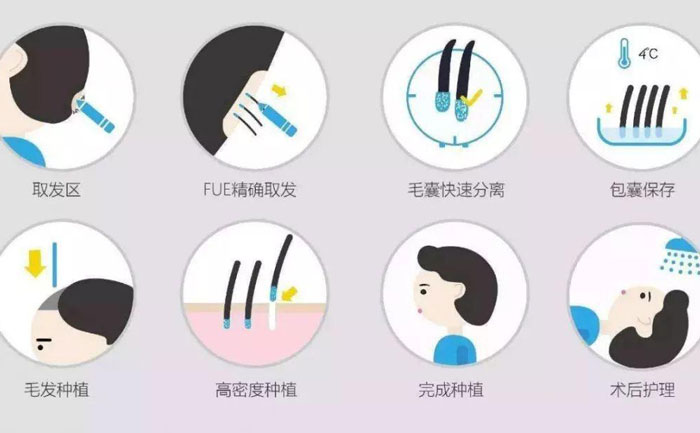 體毛種植的方法有哪些？
