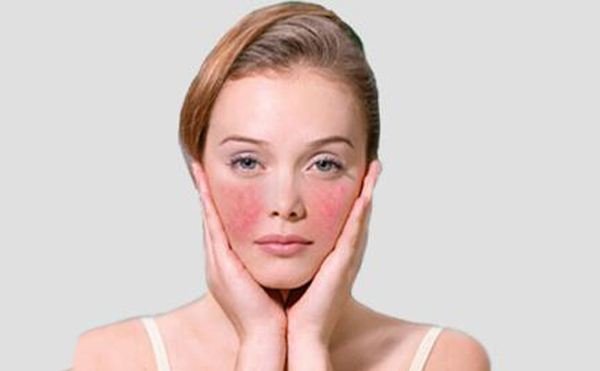 激光去紅血絲的原理是什么？