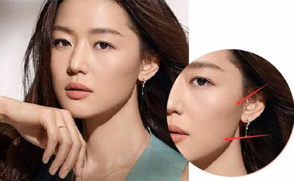 胖人先胖臉，請(qǐng)問該怎么瘦臉?