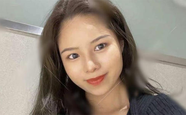 鼻再造手術成功率高嗎？