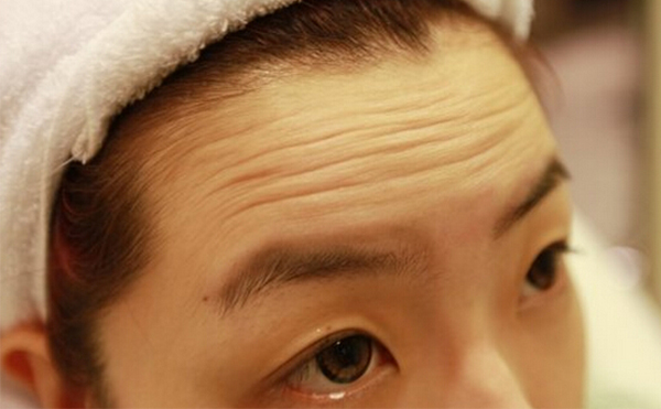 抬頭紋是怎么形成的？