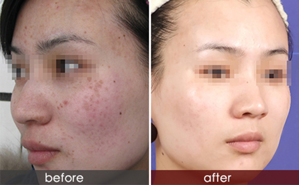 白瓷娃娃的效果怎么樣？