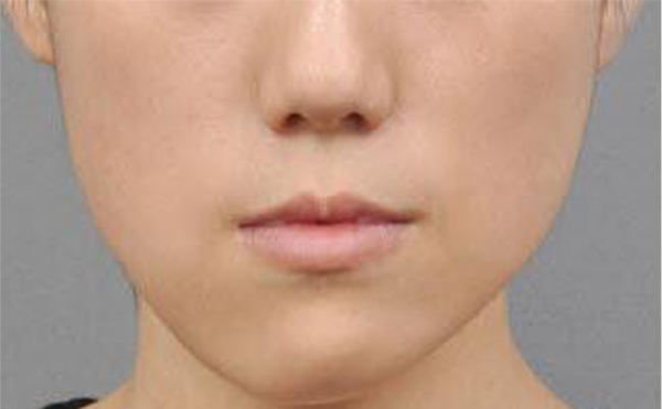 哪些小習慣會導致面部不對稱?