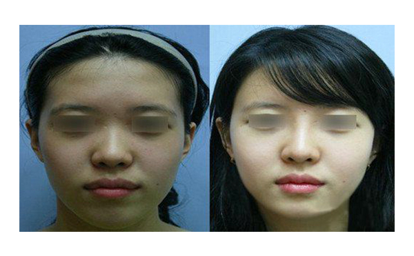 做白瓷娃娃多少錢？