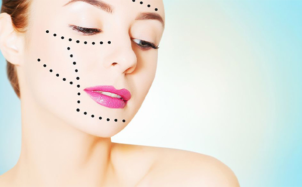 做線雕后凹陷是怎么回事？