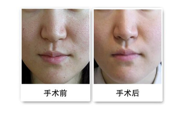 黑臉娃娃能維持多久？