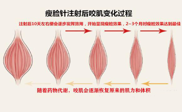 打瘦臉針打多少單位？