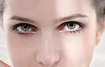 無痛去眼袋有沒有后遺癥?