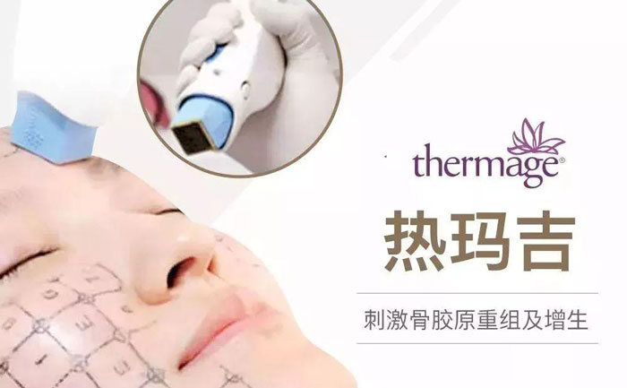 熱瑪吉除皺效果好嗎？