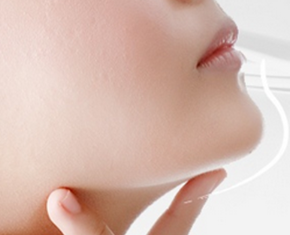 線雕可以保持多久?