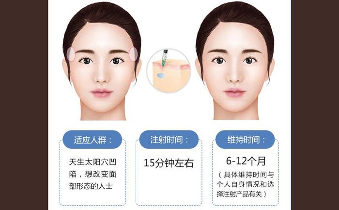 玻尿酸豐太陽(yáng)穴一般幾支？