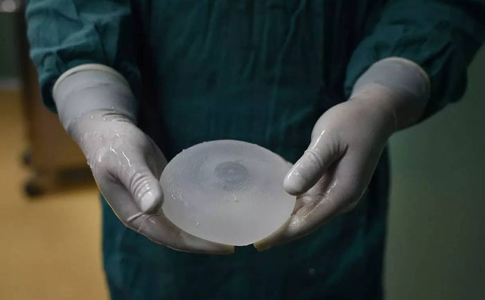 假體隆胸效果自然嗎？能維持多久？