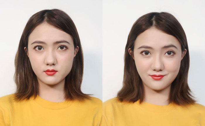 大小臉是什么原因造成的？大小臉怎么辦怎么矯正？