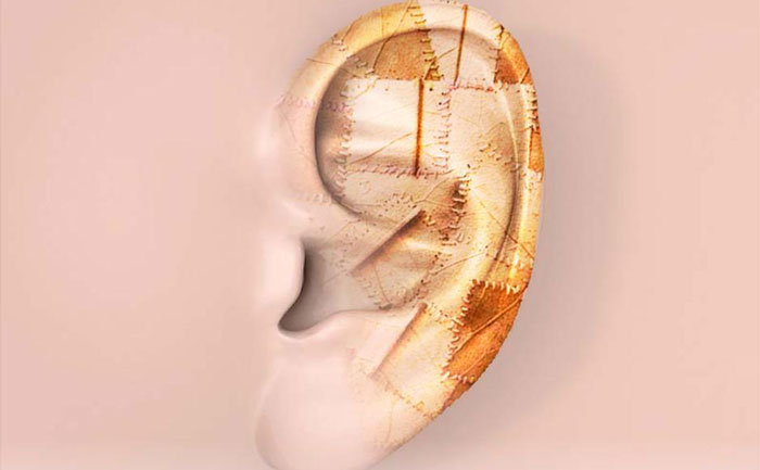 耳再造手術(shù)對(duì)軟骨有影響嗎？