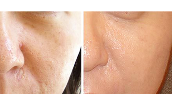 常見(jiàn)的酸有哪些?怎么選擇適合自己的?