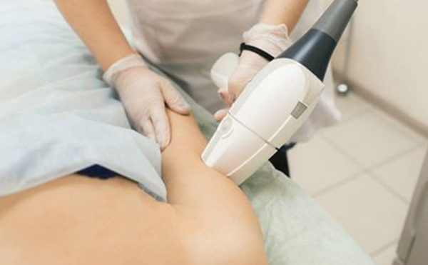 脫腋毛方法有哪些?怎么選擇合適的?