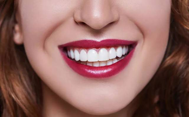 牙齒貼面怎么做？