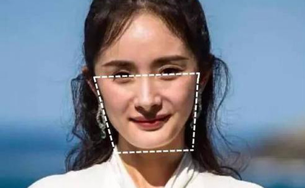 下頜角整形手術后皮膚會松弛嗎?