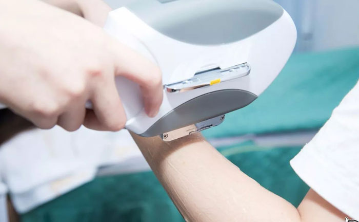 手臂脫毛多少錢？手臂脫毛幾次干凈？