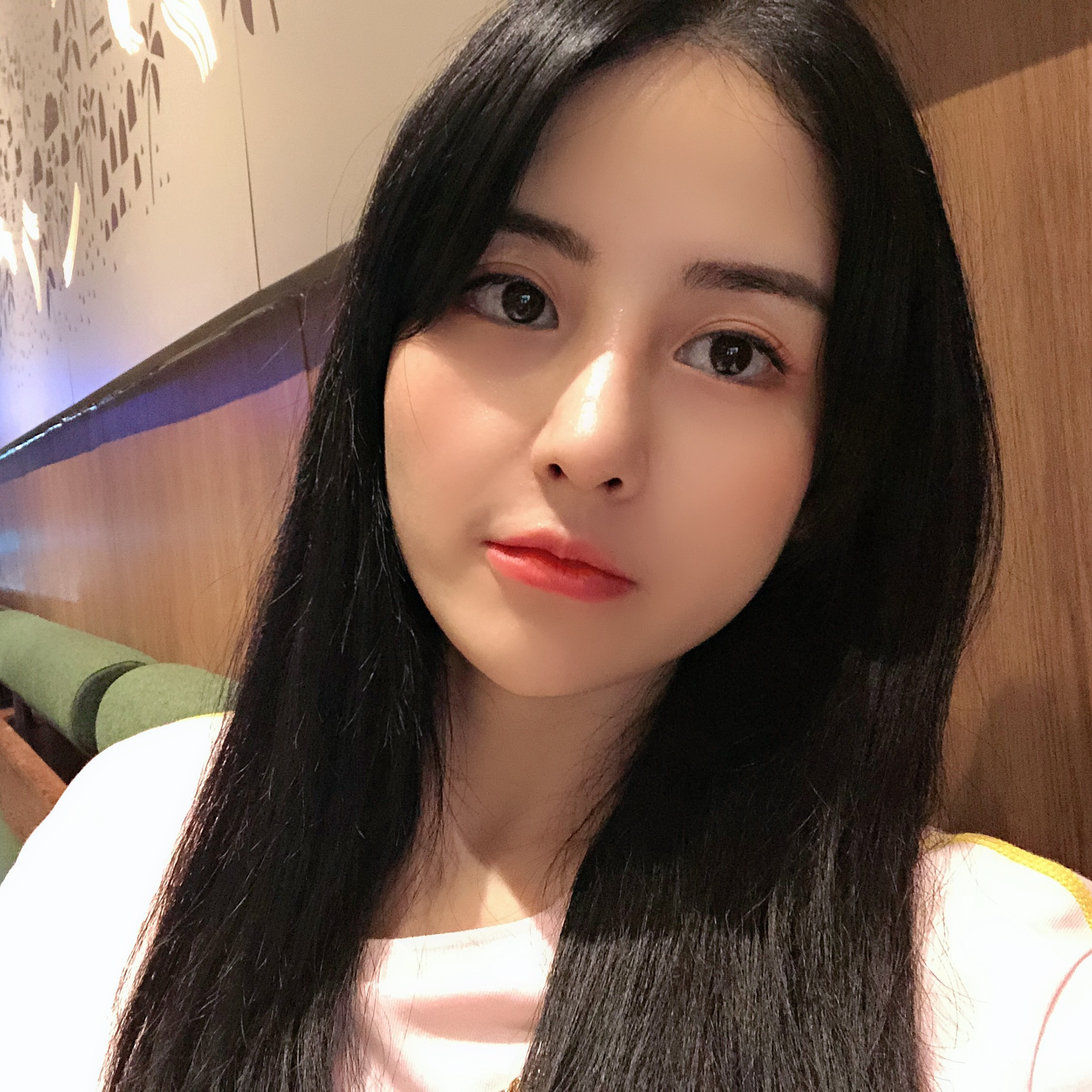 隆鼻手術術后效果3