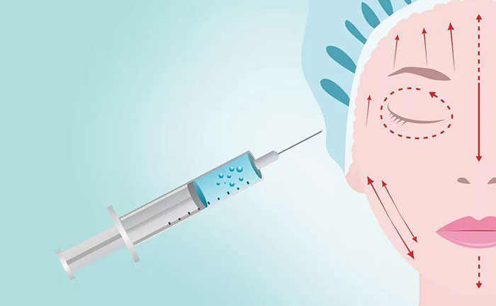 注射除皺針大概多少錢？