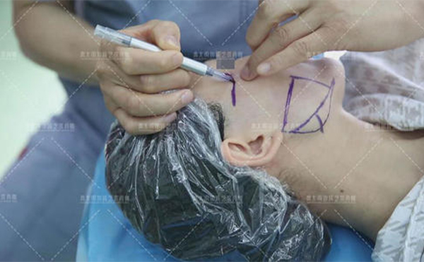 醫(yī)院醫(yī)生做改臉型手術(shù)應(yīng)遵循什么原則?術(shù)前檢查有哪些?