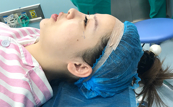 鼻綜合手術后怎樣是感染了