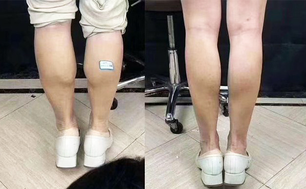 boxo瘦腿好嗎？