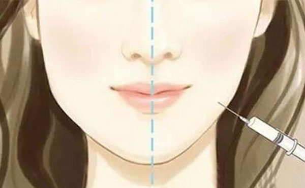 瘦臉針可能會(huì)出現(xiàn)什么風(fēng)險(xiǎn)？