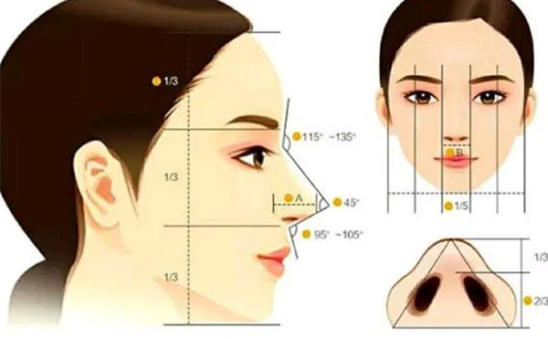 假體隆鼻恢復(fù)期要多長(zhǎng)時(shí)間？假體隆鼻不滿意還能做注射隆鼻改善嗎？