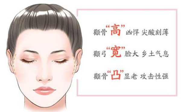 顴骨內(nèi)推整形適宜人群？