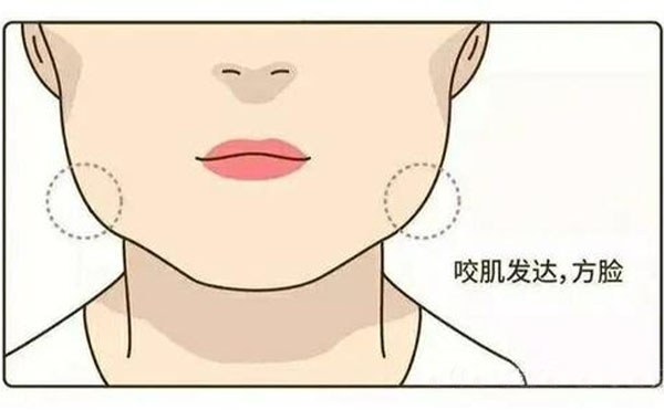 為什么咬肌會(huì)肥大？