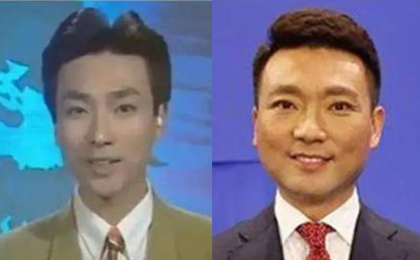 治療咬肌肥大的方法有哪些？