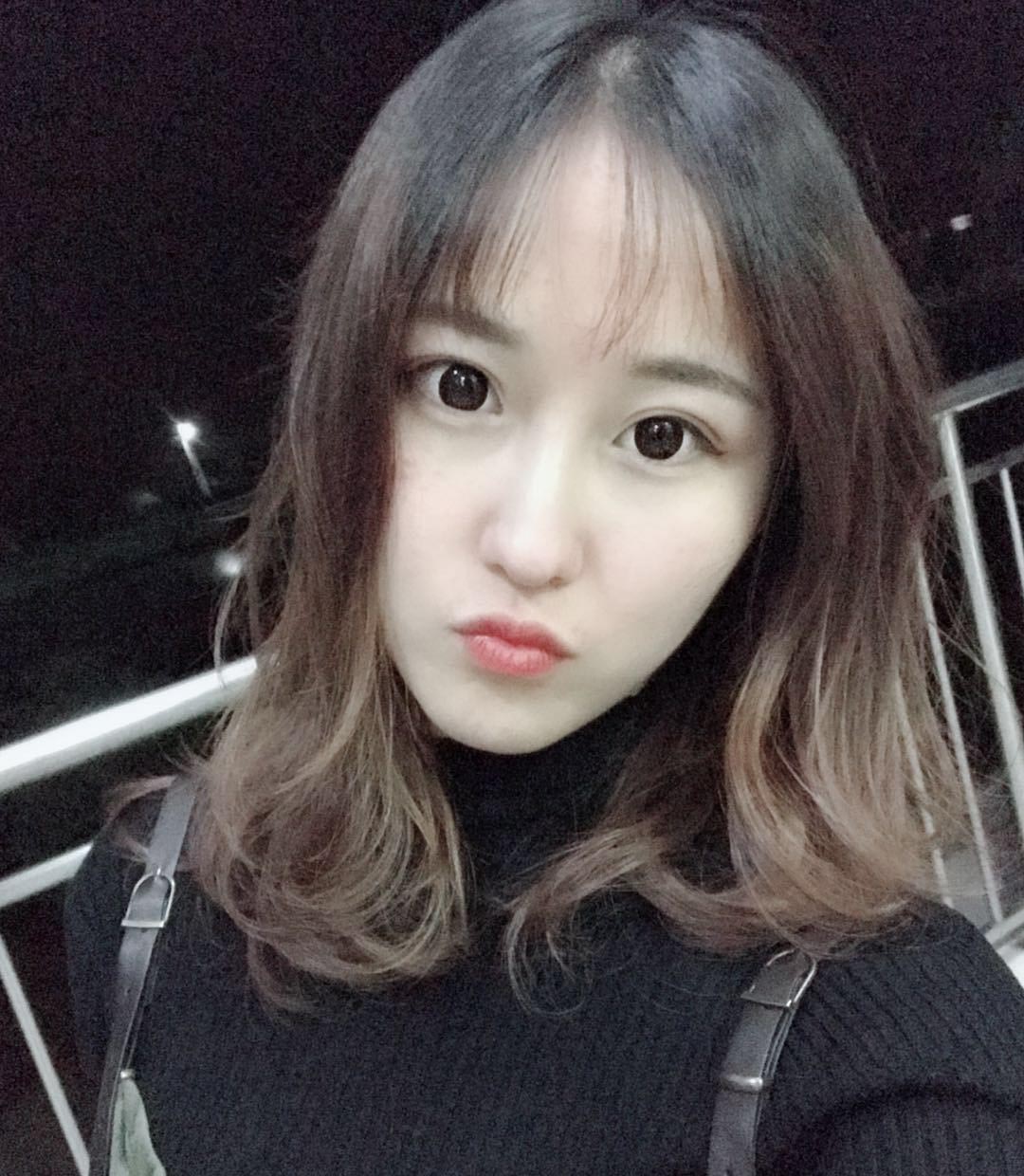 雙眼皮修復(fù)效果對(duì)比圖3