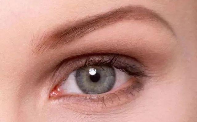 歐式雙眼皮是什么樣的？