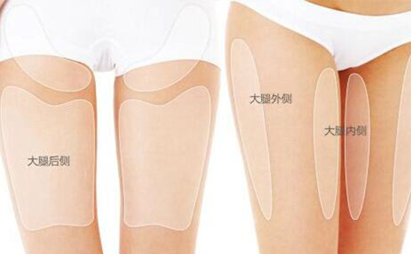 大腿吸脂的部位有哪些？