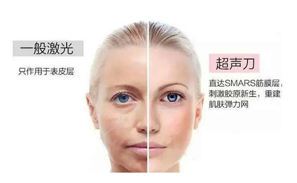 超聲刀有什么優(yōu)勢(shì)？