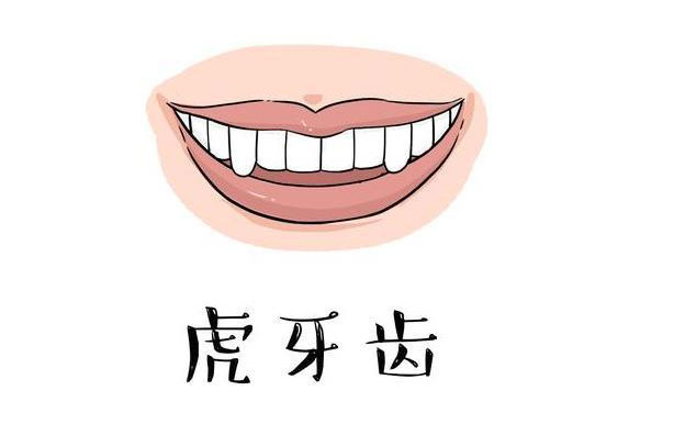 虎牙矯正需要多久？