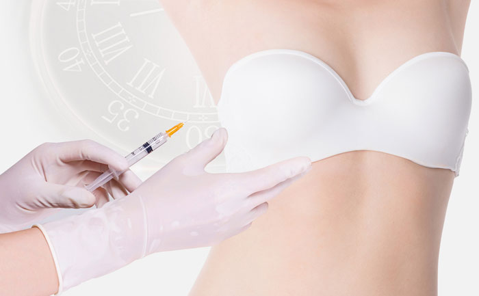 隆胸假體材料哪種好？有哪些品牌？隆胸假體材料品牌排行