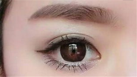 開內(nèi)眼角要多久能恢復(fù)？